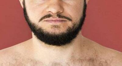 胡须种植术后注意事项有哪些？