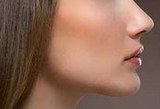 激光祛斑美容手术效果好不好啊？
