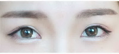 眉心中间有竖纹是什么原因