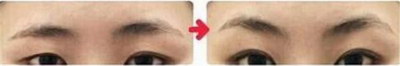 纹眉两边不一样多久可以改「纹眉是不是都会两边不一样」