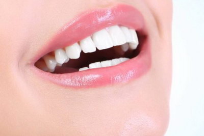 矫正牙齿每个月要复诊吗