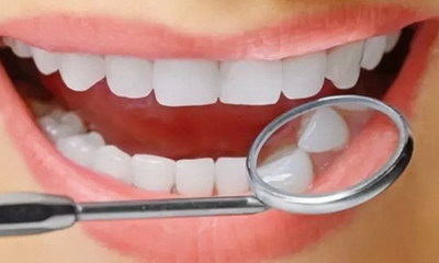 外源性色素牙齿该怎么治疗？