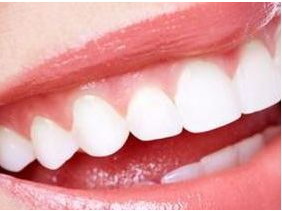 牙矫正用哪种方法效果好_牙齿怎么矫正用哪种牙膏好