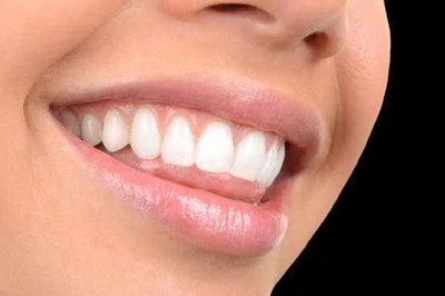 牙弓窄有什么影响_正畸牙弓弧形不对称
