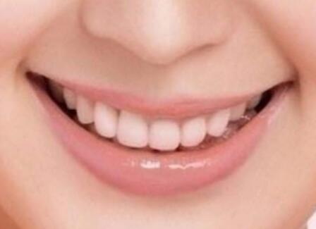 美白牙齿的方法11种(美白牙齿的几种方法)