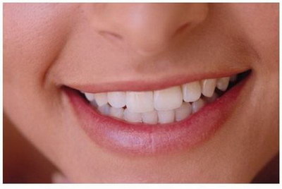 牙齿松动容易出血_拔牙后感觉旁边的牙齿松动