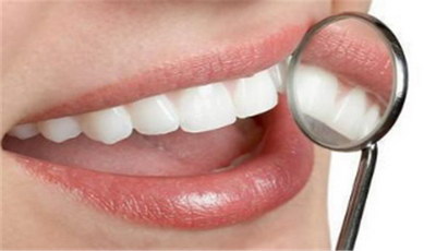 牙博士牙套的种类_牙套对龅牙有用吗