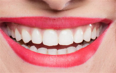 美白牙齿最好的牙膏:给你完美的美白牙齿效果(美白牙齿的牙膏哪款最好用)