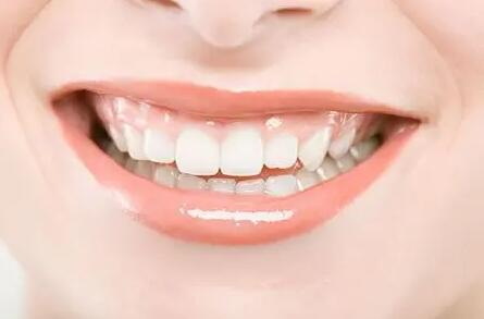 橘子能让牙齿变白吗_牙齿过敏能洗牙吗