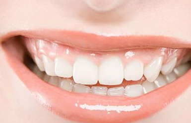 怎么可以让自己的牙齿变白_牙齿缝隙有个小洞
