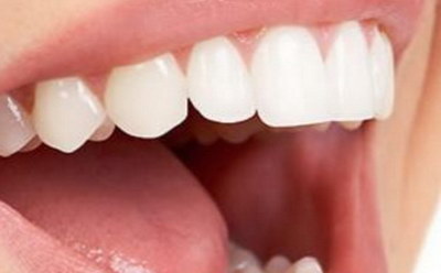 牙齿容易脏什么原因引起的(牙齿容易松动是什么原因引起的呀)