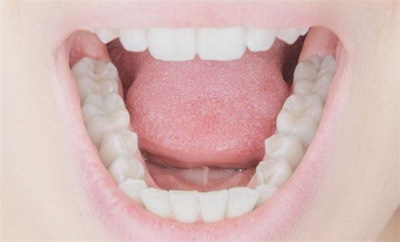 种植牙后牙龈萎缩怎么治疗(种植牙后牙龈萎缩怎么预防)