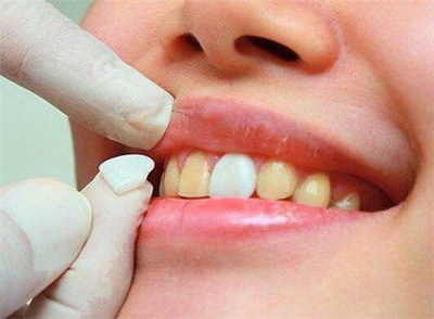 儿童多生牙倒置手术有危险吗(什么是儿童多生牙倒置手术？)