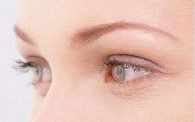 双眼皮埋线吸脂:恢复时间及其关键要素(埋线吸脂双眼皮几天恢复正常)