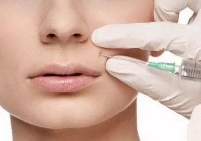 使用玻尿酸注射的方法丰唇效果如何？