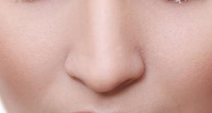 假体隆鼻的材料有哪些，是否有副作用？