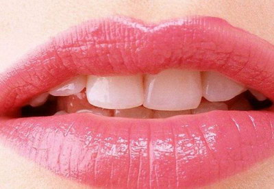 能长久保持玻尿酸丰唇的效果吗？