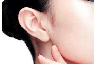 耳畸形术后注意什么