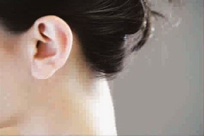 孩子耳朵畸形医院有责任吗(什么是孩子耳朵畸形？)