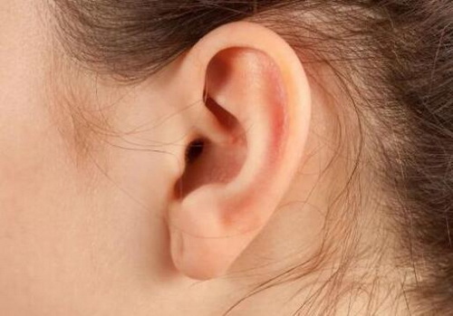 先天性耳朵畸形是基因问题吗