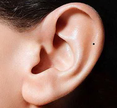 小孩出生耳朵畸形是什么原因_戴耳机耳朵外面软骨疼怎么办