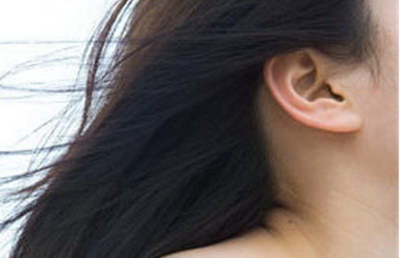 招风耳整形一般多少钱两个耳朵
