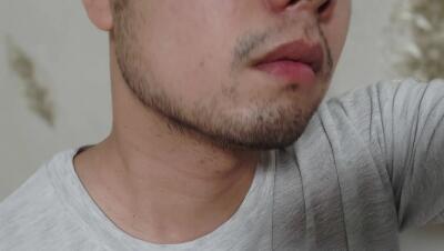 男生脸颊两侧长胡子怎么去除【男生脸颊两侧长胡子代表什么】