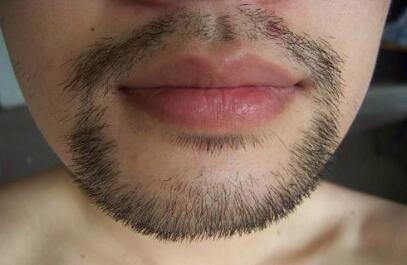 有几根很长的胡子怎样剃_怎么样永远去除胡子