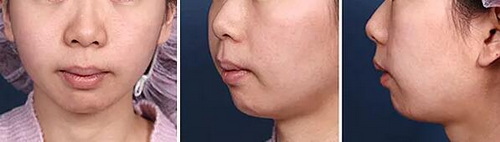 面部伤口多久可以鉴定轻伤(面部伤口会有哪些症状？)