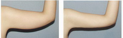 手臂分几个部位图片_手臂都是肌肉还能瘦吗