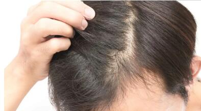 脂溢性脱发皮炎什么原因造成