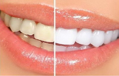 牙龈萎缩的治疗方法有哪些