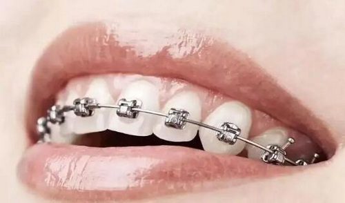 广州种牙齿安全吗