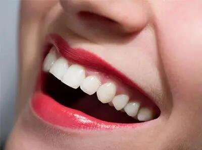 怎么美白牙齿最有效的方法(如何美白牙齿最有效？)