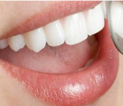 24岁矫正牙齿风险(为什么24岁矫正牙齿存在风险?)