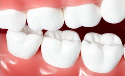 外伤性牙冠缺损修复