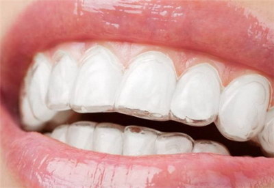 牙龈发酸怎么解决_牙龈漱口水有哪些