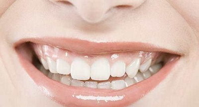 牙齿错位如何治疗_牙齿错位怎么矫正
