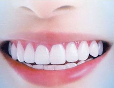 儿童牙齿间隙保持器图片_牙齿正确的咬合图片