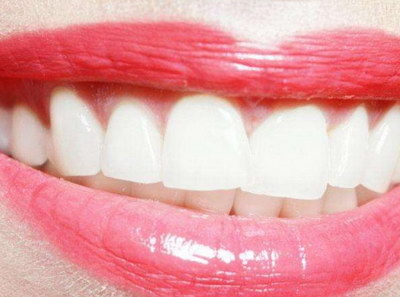 换的假牙能保持多久_拔掉满口牙齿装假牙