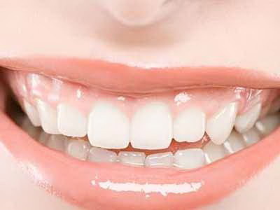 智齿长满了整个牙槽_拔完牙能看到牙槽骨吗