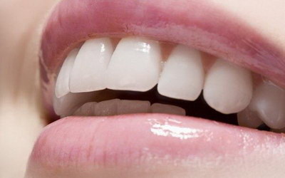 树脂材料能做牙套吗