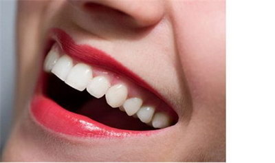 牙齿矫正怎么治疗注意什么了呢？