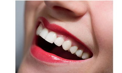 镶牙:让你获得漂亮笑容的奢华选择_镶牙好还是种牙好