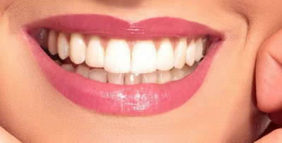 牙龈上有硬硬的像牙齿的东西是什么