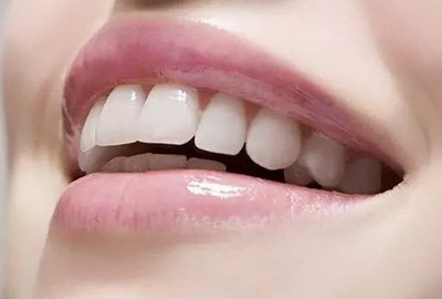 安假牙有几种类型_普通假牙杭州