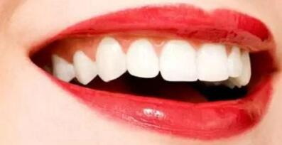 牙齿贴片能保持多长时间