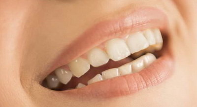 怎么使牙齿变白变健康_最快让牙齿变整齐有哪些方法