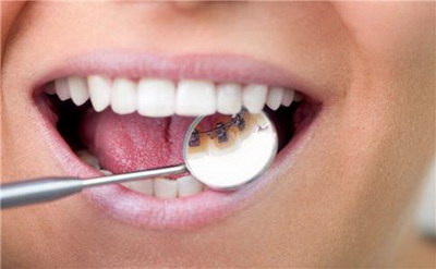 牙齿松动了有什么_牙齿牙龈大能治吗