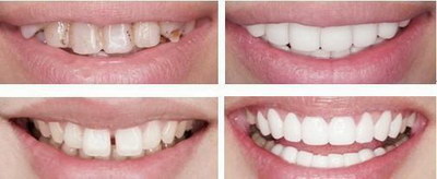 女生的牙齿为什么那么白(女生牙齿为什么那么白)